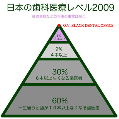 f^fB}h,,Dental,Demand,,,z,Ȏ, GVBDO,G.V. BLACK DENTAL OFFICE