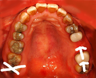 ,,Cvg,sv,p,񋸐,,,ړ,s,,,G.V. BLACK DENTAL OFFICE,GVBDO