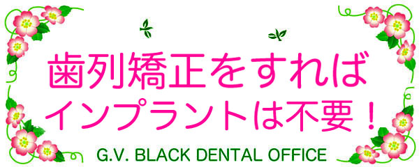 ,,Cvg,sv,p,񋸐,,,ړ,s,,,G.V. BLACK DENTAL OFFICE,GVBDO,