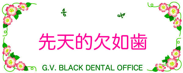 メタルボンド,メタボン,奥歯,大臼歯,GVBDO,G.V. BLACK DENTAL OFFICE