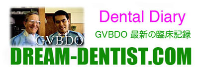 歯列矯正,デメリット,リスク,問題点,短所,顎関節症,虫歯,歯根吸収,画像,費用,動画, youtube, GVBDO, G.V. BLACK DENTAL OFFICE