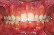 �ŐV,�A�����J,���Ȏ���,�{�֐ߏ�,���񋸐�,���ǎ���,���ÏǗ�W,�J�Y�C�X�`�J, Evidence Based,Medicine, EBM,����,GVBDO,G.V. Black Dental Office