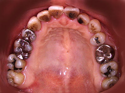 񋸐,s,Ǘ,a,dx,,摜,{؎p,,GVBDO,G.V. BLACK DENTAL OFFICE,R,sO,쌴s,匎s,E쑺,bs,,bBs,b{s,,a,OgR,s,ss,u,,암,j,Bs,쒬,Js,xm͌Β,xmgcs,kms,䒬,AvXs,g,RΑ,Rs,