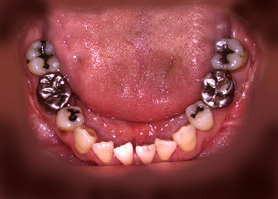 񋸐,s,Ǘ,a,dx,,摜,{؎p,,GVBDO,G.V. BLACK DENTAL OFFICE,