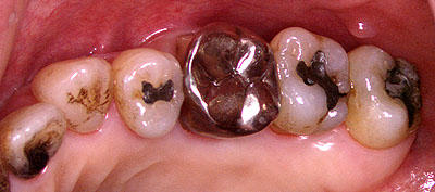 񋸐,s,Ǘ,a,dx,,摜,{؎p,,GVBDO,G.V. BLACK DENTAL OFFICE,