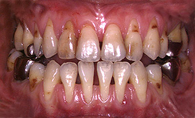 񋸐,s,Ǘ,a,dx,,摜,{؎p,,GVBDO,G.V. BLACK DENTAL OFFICE,