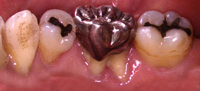 񋸐,s,Ǘ,a,dx,,摜,{؎p,,GVBDO,G.V. BLACK DENTAL OFFICE,