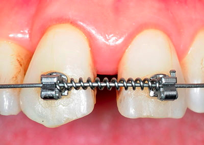 ���񋸐���,��������,���@,�摜,�O��,���W��,�ʐ^,����,G.V. BLACK DENTAL OFFICE,GVBDO,