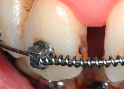 ���񋸐���,��������,���@,�摜,�O��,���W��,�ʐ^,����,G.V. BLACK DENTAL OFFICE,GVBDO,