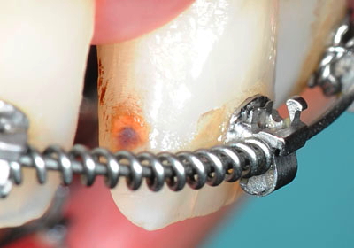 �����񋸐���,��������,���@,�摜,�O��,���W��,�ʐ^,����,G.V. BLACK DENTAL OFFICE,GVBDO,