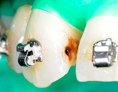 ���񋸐���,��������,���@,�摜,�O��,���W��,�ʐ^,����,G.V. BLACK DENTAL OFFICE,GVBDO,,