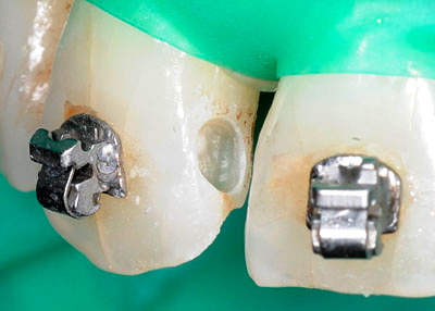 ���񋸐���,��������,���@,�摜,�O��,���W��,�ʐ^,����,G.V. BLACK DENTAL OFFICE,GVBDO,,