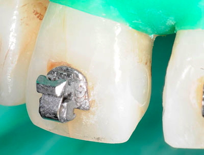 ���񋸐���,��������,���@,�摜,�O��,���W��,�ʐ^,����,G.V. BLACK DENTAL OFFICE,GVBDO,,