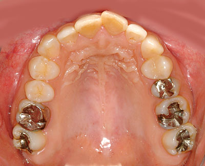 ݍ킹,s,,ɗ͓炸,{֐ߏ,₦,GVBDO,G.V. BLACK DENTAL OFFICE,