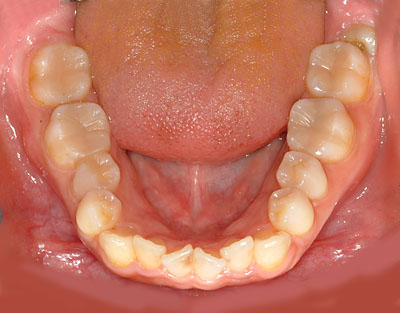 ݍ킹,s,,ɗ͓炸,{֐ߏ,₦,GVBDO,G.V. BLACK DENTAL OFFICE,