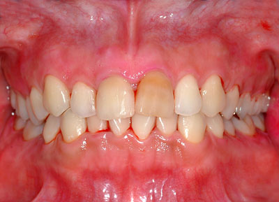 ݍ킹,s,,ɗ͓炸,{֐ߏ,₦,GVBDO,G.V. BLACK DENTAL OFFICE,