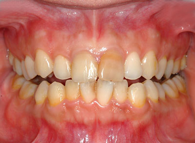 ݍ킹,s,,ɗ͓炸,{֐ߏ,₦,GVBDO,G.V. BLACK DENTAL OFFICE,