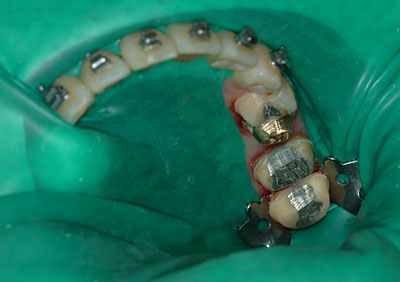 Cvg,sv,֎,Ȏ,,Ƃ́H,,摜,t,Ǘ,,GVBDO, G.V. BLACK DENTAL OFFICE
