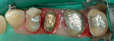 Cvg,sv,֎,Ȏ,,Ƃ́H,,摜,t,Ǘ,,GVBDO, G.V. BLACK DENTAL OFFICE
