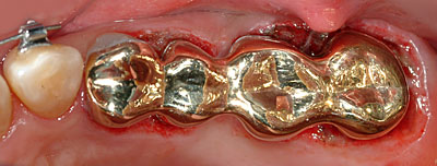 Cvg,sv,֎,Ȏ,,Ƃ́H,,摜,t,Ǘ,,GVBDO, G.V. BLACK DENTAL OFFICE