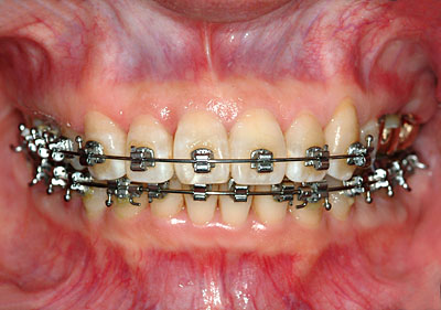 Cvg,sv,֎,Ȏ,,Ƃ́H,,摜,t,Ǘ,,GVBDO, G.V. BLACK DENTAL OFFICE
