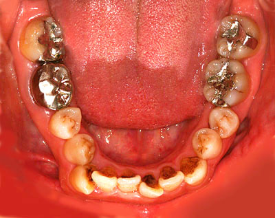 ,q,Ȏ,Ă炢.ǂ,ǂ,,e,s,@,Ƃ́H,GVBDO,G.V. BLACK DENTAL OFFICE,