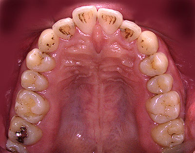 Ђ,soZ,Ƃ,{֐ߏ, ȋ| ,SÎ ,qf, , R,xR ,,É, GVBDO, G.V. BLACK DENTAL OFFICE,