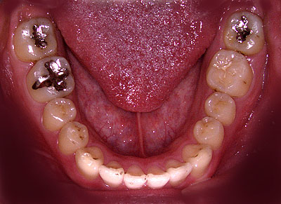 Ђ,soZ,Ƃ,{֐ߏ, ȋ| ,SÎ ,qf, , R,xR ,,É, GVBDO, G.V. BLACK DENTAL OFFICE,