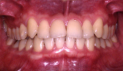 Ђ,soZ,Ƃ,{֐ߏ, ȋ| ,SÎ ,qf, , R,xR ,,É, GVBDO, G.V. BLACK DENTAL OFFICE