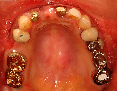 YLYL,, , ,u, ,ݒ, j, s ,d, ,Q, Ђ,GVBDO,G.V. BLACK DENTAL OFFICE