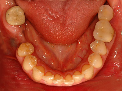 YLYL,, , ,u, ,ݒ, j, s ,d, ,Q, Ђ,GVBDO,G.V. BLACK DENTAL OFFICE