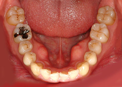  {֐ߏ,T,,a,,xE,Õ@,,l,,fpX,Ö,,,G.V. BLACK DENTAL OFFICE ,GVBDO