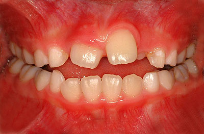 iv,ւ,O,,摜,,w,,U ,V, ,,G.V. BLACK DENTAL OFFICE,GVBDO,