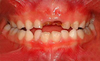 iv,ւ,O,,摜,,w,,U ,V, ,,G.V. BLACK DENTAL OFFICE,GVBDO,