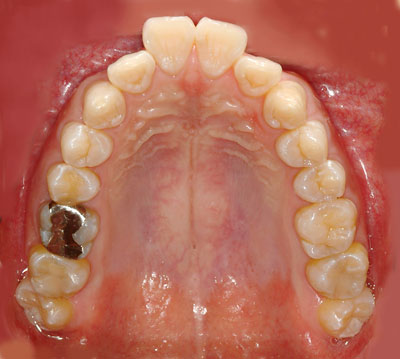 ݍ킹, , {֐ߏ, , Õ@, , l, ,_a, т傤, psychosis, ϑz, o, , Ǐ, , Ǐ, _aQ, psychotic, disorder, _, _Q, Na, , G.V. BLACK DENTAL OFFICE, GVBDO