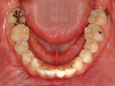 ݍ킹, , {֐ߏ, , Õ@, , l, ,_a, т傤, psychosis, ϑz, o, , Ǐ, , Ǐ, _aQ, psychotic, disorder, _, _Q, Na, , G.V. BLACK DENTAL OFFICE, GVBDO