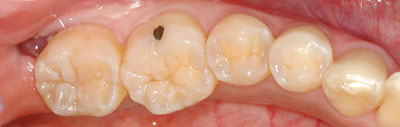 ݍ킹, , {֐ߏ, , Õ@, , l, ,_a, т傤, psychosis, ϑz, o, , Ǐ, , Ǐ, _aQ, psychotic, disorder, _, _Q, Na, , G.V. BLACK DENTAL OFFICE, GVBDO