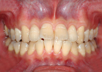 ݍ킹, , {֐ߏ, , Õ@, , l, ,_a, т傤, psychosis, ϑz, o, , Ǐ, , Ǐ, _aQ, psychotic, disorder, _, _Q, Na, , G.V. BLACK DENTAL OFFICE, GVBDO