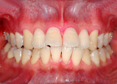 ݍ킹, , {֐ߏ, , Õ@, , l, ,_a, т傤, psychosis, ϑz, o, , Ǐ, , Ǐ, _aQ, psychotic, disorder, _, _Q, Na, , G.V. BLACK DENTAL OFFICE, GVBDO