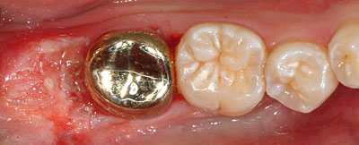 ݍ킹, , {֐ߏ, , , l, ,_a, т傤, psychosis, ϑz, o, , Ǐ, , Ǐ, _aQ, psychotic, disorder, _, _Q, Na, , G.V. BLACK DENTAL OFFICE, GVBDO