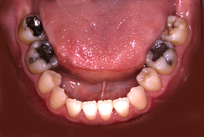 񋸐,s,ݍ킹,Ȃ,,炪c,֐߂,@`,@Ȍn,,GVBDO,G.V. BLACK DENTAL OFFICE