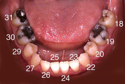 dx̎a,񋸐,ꎕ,,Cvg,Ȃ,֎,摜,Ǘ,GVBDO,G.V. BLACK DENTAL OFFICE