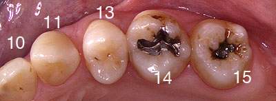 񋸐,s,ݍ킹,Ȃ,,炪c,֐߂,@`,@Ȍn,,GVBDO,G.V. BLACK DENTAL OFFICE