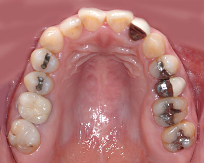 40��,�����ꎕ,��@,30��,����,����,�C���v�����g,G.V. BLACK DENTAL OFFICE,GVBDO