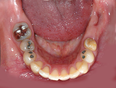 40��,�����ꎕ,��@,30��,����,����,�C���v�����g,G.V. BLACK DENTAL OFFICE,GVBDO