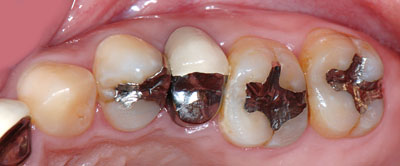 40��,�����ꎕ,��@,30��,����,����,�C���v�����g,G.V. BLACK DENTAL OFFICE,GVBDO