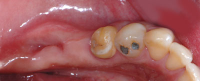 40��,�����ꎕ,��@,30��,����,����,�C���v�����g,G.V. BLACK DENTAL OFFICE,GVBDO