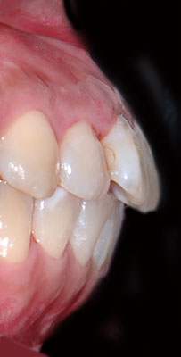 40��,�����ꎕ,��@,30��,����,����,�C���v�����g,G.V. BLACK DENTAL OFFICE,GVBDO
