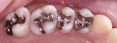 q{,,,_o,,Õ@,q{؎,s,,,G.V. BLACK DENTAL OFFICE,GVBDO