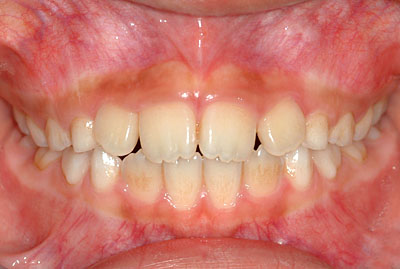 q̎,ς,,{,ϐF,iv,,,G.V. BLACK DENTAL OFFICE,GVBDO,,